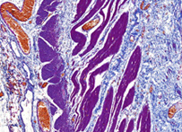 Trichrome stain